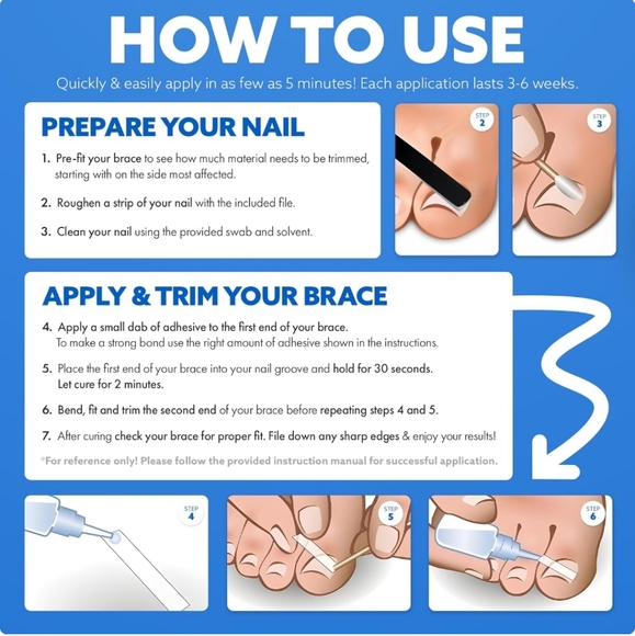 Curve Correct Ingrown Toenail Corrector Kit - Picture 6 of 9